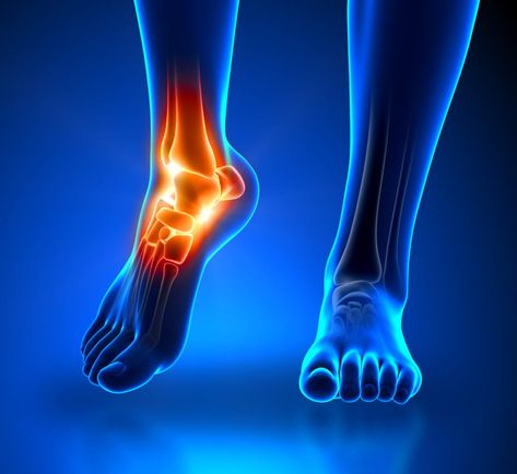 Ankle Replacement, Dirty Questions, Partial Knee Replacement, Ankle Fracture, Foot Reflexology Massage, Ankle Pain, Foot Reflexology, Knee Replacement, Sciatic Nerve