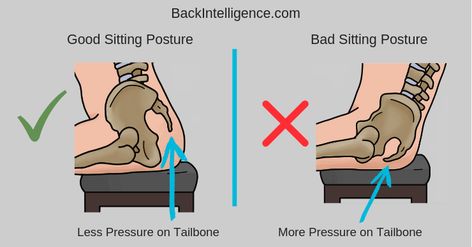 Tailbone Pain When Sitting (Coccydynia) - DIY Relief & Exercises Tailbone Pain, Coccyx Pain Relief Exercise, Sacrum Pain Relief, Tail Bone Pain Relief Exercise, Tailbone Pain Relief Stretches, Tailbone Pain Relief, Coccyx Pain Relief, K Tape, Referred Pain