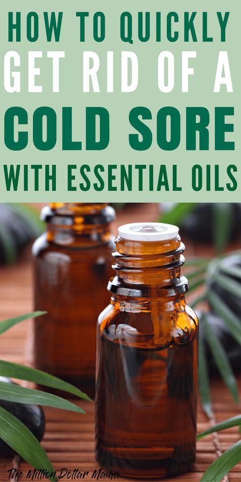 Natural Cold Sore Remedy That Really Works - How to Quickly Get Rid of a Cold Sore With Essential Oils Natural Cold Sore Remedy, Essential Oils For Colds, Cold Sores, Cold Sores Remedies, Natural Healing Remedies, Cold Home Remedies, Cough Remedies, Cold Sore, Cold Remedies