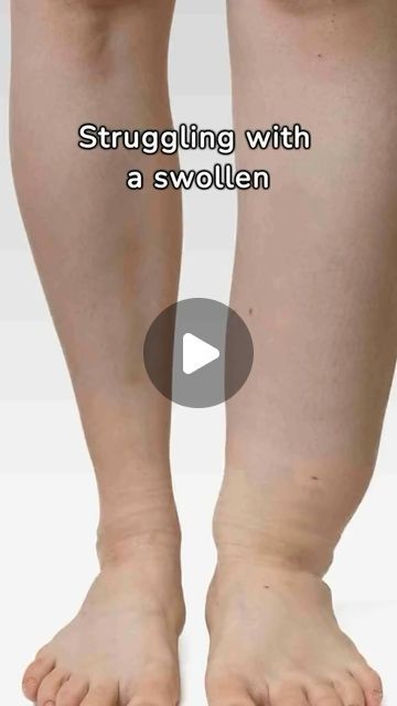 Swollen Legs Remedies, Celtic Salt, Swollen Ankles, Dandelion Tea, Lymph Drainage, Swollen Legs, Fluid Retention, Health Recipes, Back Pain Exercises