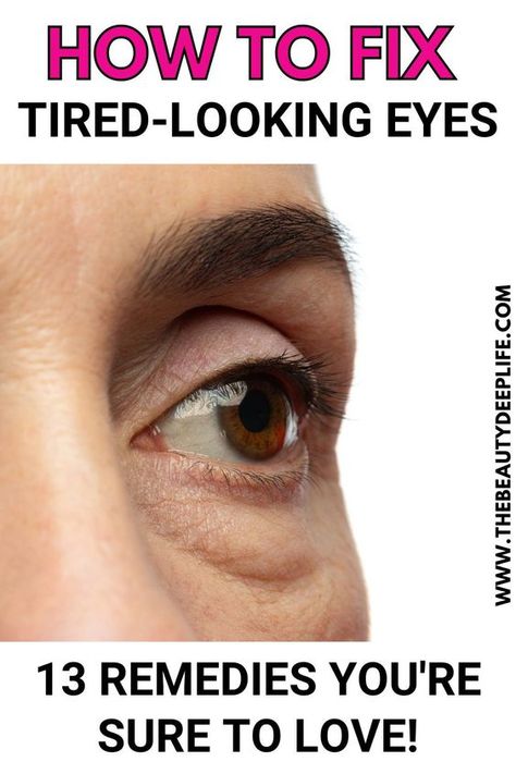 Eye Wrinkles Remedies, Tired Looking Eyes, Puffy Eyes Remedy, Baggy Eyes, Wrinkle Remedies, Mind Diet, Tips Skincare, Under Eye Puffiness, Under Eye Wrinkles