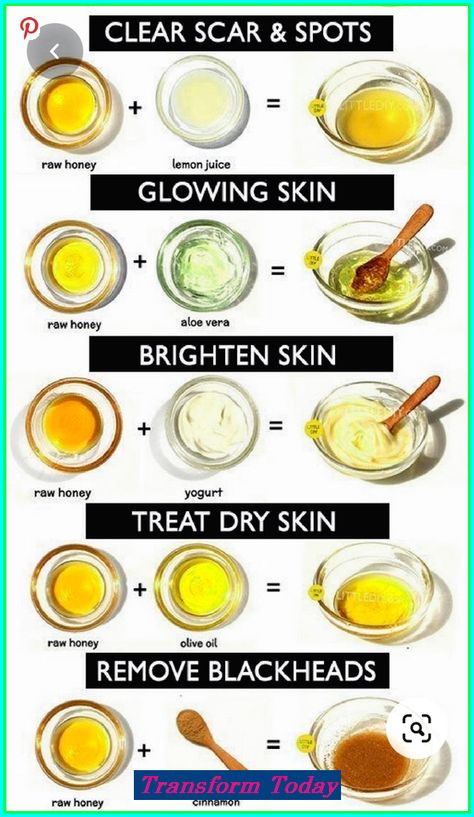 💞 Perfect Skin – The Comprehensive Solution for All Your Needs! blackheads removal, skin care, affordable skin care 😘 Please re-pin 😍💞 #kbeauty #naturalskincare #antiaging Olive Oil Skin, Skin Care Home Remedies, Aesthetic Health, Health Aesthetic, Nails Health, Tattoo Health, Health Hair, Honey Yogurt, Health Art