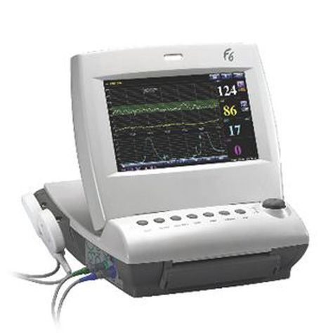 Fetal Monitor F6 - MedGyn Fetal Monitor Single or Twin FHR Color Display, Office Phone, Healthcare Professionals, Twins, Medical, Color