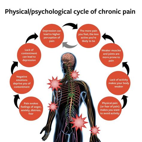 Pain Medicine, Causes Of Back Pain, Health Psychology, Mental Health Disorders, Physical Pain, Clinical Psychologist, Nerve Pain, Radio Frequency, Negative Emotions