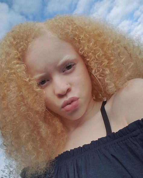 “Be color blind, don’t be so shallow. Free Your Mind!”-En Vogue 😘 Credit: @uniquely_kyahhh #TressfullyYours #HairInspirations #HairGoals… Albino Model, Albino Girl, Hype Hair, Dyed Curly Hair, Free Your Mind, Vintage Black Glamour, Color Blind, African Girl, Hair Inspo Color