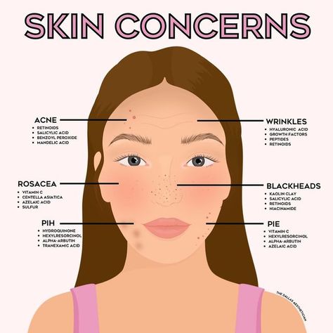 Esthetician Recommended Products, Dallas Esthetician, Skin Acids Guide, The Dallas Esthetician, Skin Care Acids Guide, Esthetician Tips Facts Skin Care, Skincare Acids Guide, Face Reality, Mandelic Acid