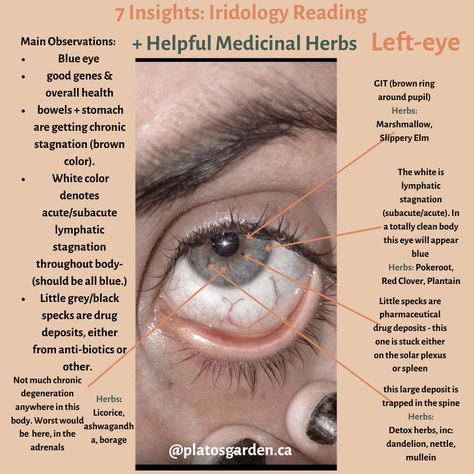 Iridology Reading, Iridology Chart, Eye Reading, Eye Facts, Medical School Studying, Health Hacks, Acupressure Points, Meeting Place, Face Yoga