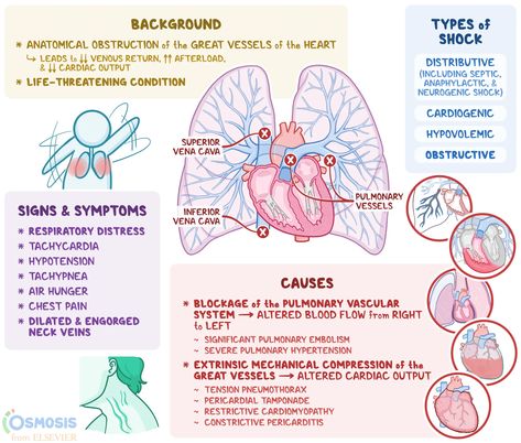 Obstructive Shock: What Is It, Causes, Diagnosis, and More… | Osmosis Obstructive Shock, Shock Medical, Superior Vena Cava, Types Of Shock, Cardiogenic Shock, Nursing School Essential, Brain Surgeon, Medicine Notes, Heart Diseases