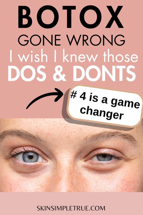 botox dos and donts for beginners Botox For Migraine, Botox After Care, Botox Benefits, Botox Vs Fillers, Botox Eyes, Botox Under Eyes, Botox Aftercare, Botox Migraine, Botox Tips