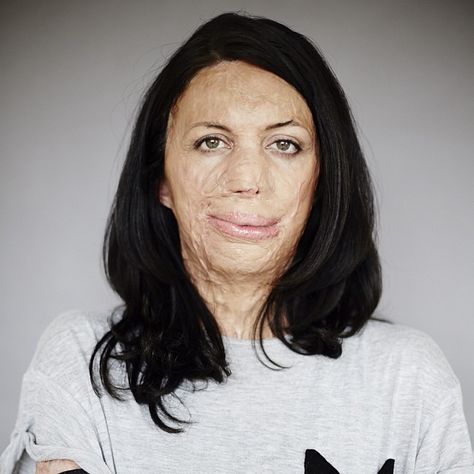 Burned Over 65 Percent of Her Body, Turia Pitt Shows Us What It Means to Persevere Burn Victims, Theatre Makeup, Dark Underarms, Popular Magazine, People Of Interest, Women Magazines, Cover Model, Social Change, Inspirational Women