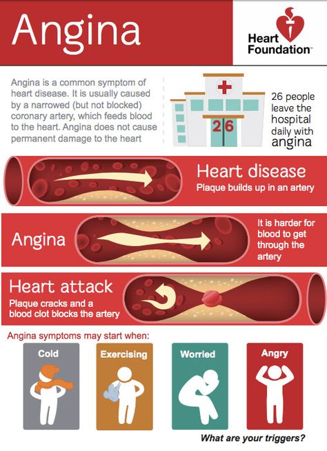 Emt Study, Medical Symptoms, Nursing School Essential, Angina Pectoris, Nursing School Survival, Nursing School Studying, Nursing School Tips, Medical School Studying, Nursing School Notes