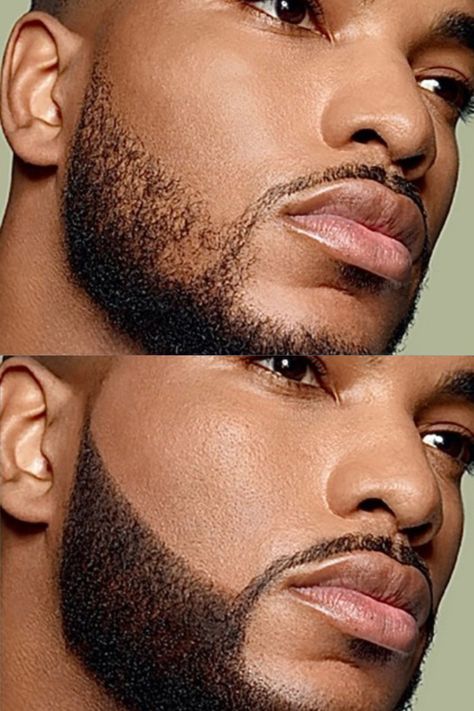 Beard Micropigmentation - Behacks.com Beard Game, Get Ready, It Works, Benefits, Confidence