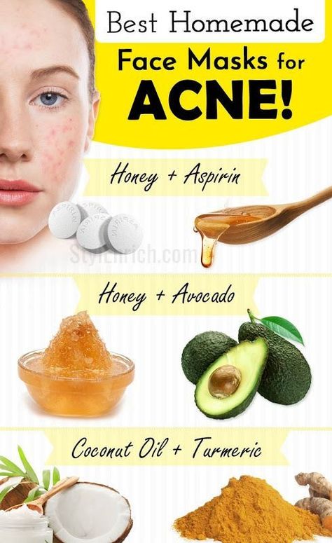 Best Homemade Face Mask for Acne | My-FavThings | Bloglovin’ Homemade Face Mask For Acne, Diy Exfoliating Face Scrub, Skin Care Face Masks, Diy Honey Face Mask, Face Masks For Acne, Best Homemade Face Mask, Masks For Acne, Green Tea Face Mask, Face Mask For Acne