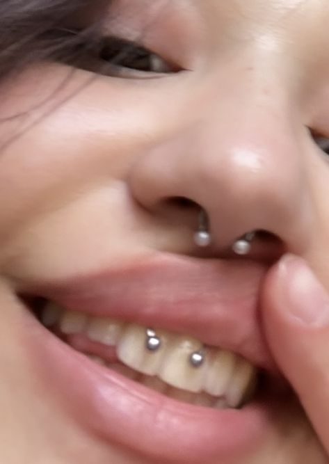 Smiley Piercing And Septum, Face Peircing Ideas, Smile And Septum Piercing, Septum And Smiley Piercing, Smiley Piercing Aesthetic, Face Piercing Ideas, Gum Piercing, Piercing Mouth, Piercings Women