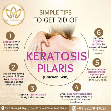 skincare nature products How To Get Rid Of Keratosis Pilaris, Keratosis Pilaris On Face, Maya Aesthetic, Skin Notes, Coconut Oil Massage, Alcone Makeup, Medical Esthetician, Twists Braids, Skin Facts