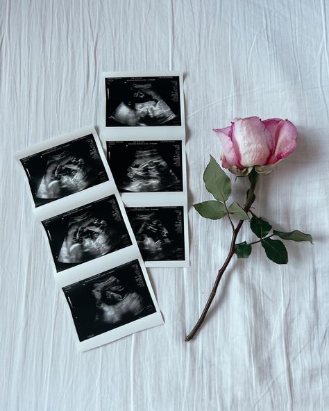 10 Week Ultrasound Pictures, Positive Pregnancy Test Pictures, Second Baby Announcement, Ultrasound Pregnancy Announcement, Ultrasound Reveal, Baby Ultrasound Pictures, Ultrasound Announcement, Simple Pregnancy Announcement, Pregnancy Announcement Pictures