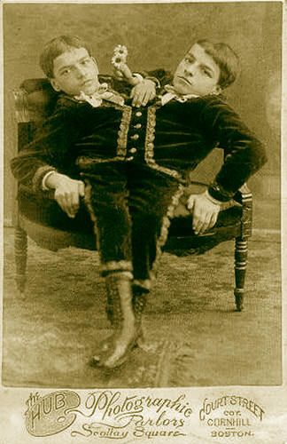 16 Shocking Things About the Tocci Brothers, Famous Conjoined Twins Who Retired at 20 Siamese Twins, Old Circus, Sideshow Freaks, Circus Sideshow, Human Oddities, Conjoined Twins, Two Heads, Vintage Circus, Medical History