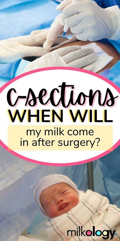 When Will My Milk Come In After C-Section Surgery? — Milkology® When Does Breastmilk Come In, When Does Milk Come In After Birth, Dry Up Breastmilk, When To Start Pumping, Milk Booster, Breastfeeding After C Section, Extended Breastfeeding, Increase Breastmilk, Milk Flow