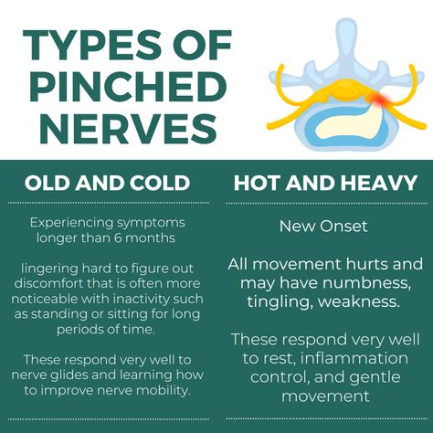 Effective Tips for Loosen a Pinched Nerve Pinched Sciatic Nerve, Back Relief, Pinched Nerve, Sciatic Nerve Pain, Medical Anatomy, Sciatic Nerve, Nerve Pain, Massage Therapist, Nerve