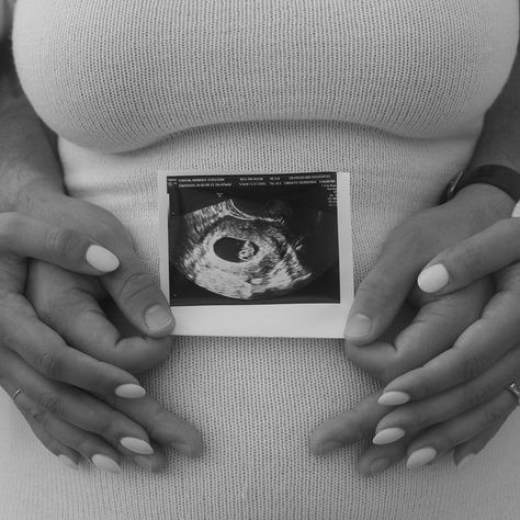 baby in bloom 🤍 obsessed with our gallery from @kelseyscollective 🫶🏽 capturing this moment in time was so special for us 🥹 • #babyannouncement #babyonboard #pregnancy #pregnant #preggo Pregnant Announcement, Pregnancy Announcement Pictures, Announcement Pictures, Baby In Bloom, Pregnancy Announcement To Husband, Moment In Time, Maternity Shoot, Pregnancy Shoot, Maternity Pictures