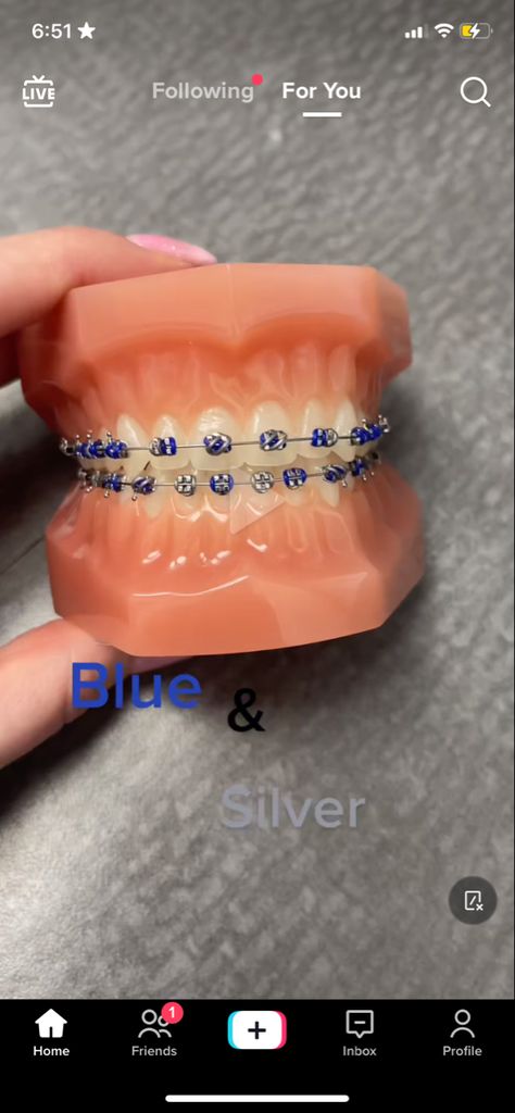 Navy Blue Braces Teeth, Braces Navy Blue, Dark Blue Braces, Navy Blue Braces, Brace Ideas, Power Chains, Braces Colours, Blue Braces, Braces Ideas