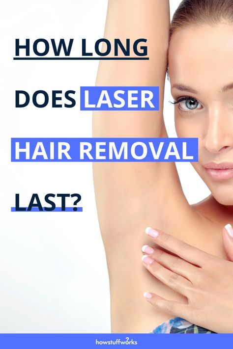 Whether you wax, shave, or use Nair, you've probably thought about researching a longer term solution. Read on to find out if permanent laser hair removal is really permanent. Laser Hair Remover, Laser Hair Removal Facts, Natural Hair Removal Remedies, Best Permanent Hair Removal, Permanent Laser Hair Removal, Hair Removal Diy, Unwanted Hair Permanently, Unwanted Hair Growth, Permanent Hair Removal