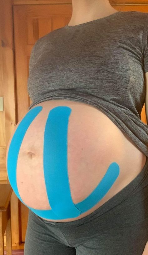 10 Ways to Use Kinesiology Taping for Pregnancy - Prokit Pregnant Belly Taping, K Tape For Pregnancy, Kinesio Tape Pregnancy, Pregnancy Tape Belly, K Tape Pregnancy, Pregnancy Belly Taping, Belly Taping For Pregnancy, Tape Pregnant Belly, Kt Tape For Pregnant Belly