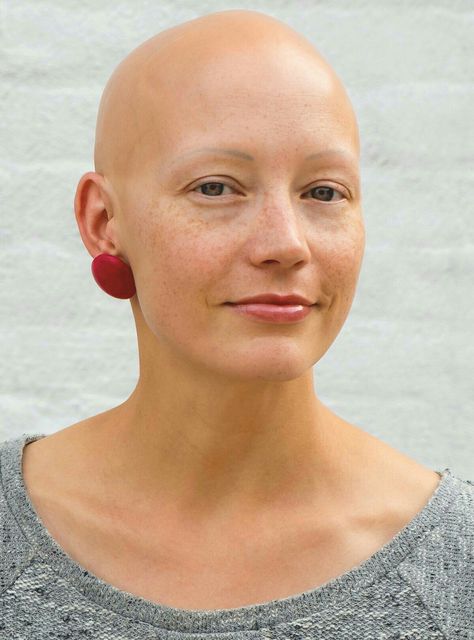 Jennifer Bald Women Fashion, Helen Phillips, No Eyebrows, Losing Hair, Shaved Head Women, Shaved Heads, Shave My Head, Going Bald, Bald Girl