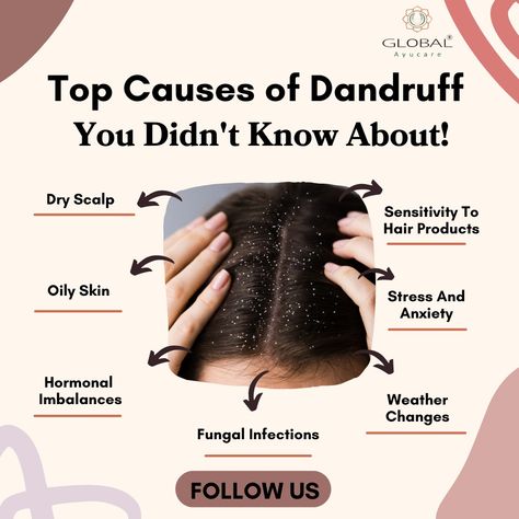 😲 Did you know dandruff has unexpected causes? It’s not just about dry scalp! Learn the surprising reasons and how to keep your hair flake-free! 💇‍��♀️✨ 👉Click Here To Buy Herbal Products[https://tinyurl.com/yrmfnwz3] #DandruffTips #HealthyScalp #HairCareHacks #DandruffSolutions #HairHealth #WellnessTips #GlobalAyucareHerbal Hair Flakes, Dandruff Solutions, Ayurvedic Remedies, Herbal Products, Weather Change, Fungal Infection, Healthy Scalp, Dry Scalp, Hormone Imbalance