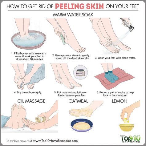 Here are some tips and remedies on how to get rid of peeling skin on feet with exfoliation and foot masks to relieve dryness. Top 10 Home Remedies, Combination Skin Type, Peeling Skin, Skin Care Steps, Dry Skin Care, Oily Skin Care, Skin Remedies, Organic Skin, Homemade Skin Care