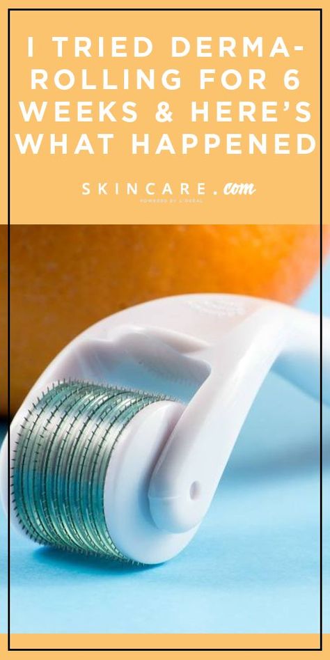 Micro Needling Benefits, Derma Roller Results, Skincare Gadgets, Rolling Face, Skin Wars, Derma Rolling, Microneedle Derma Roller, Calorie Snacks, Skin Needling