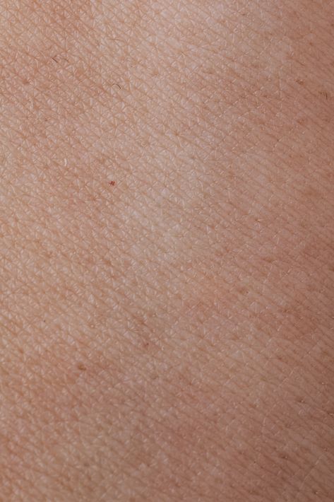 Human Skin Texture, Skin Photo, Free Textures, Adobe Photoshop Lightroom, New Images, Reference Images, Photoshop Lightroom, Canon Eos, Free Stock Photos