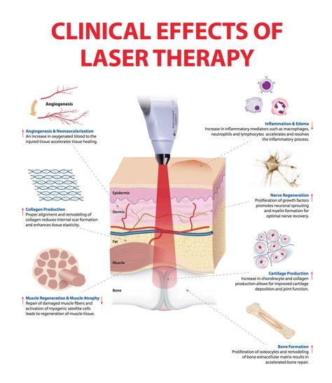 Cold Laser Therapy, Muscle Atrophy, Led Therapy, Decrease Inflammation, Skin Science, Tension Headache, Laser Therapy, Led Light Therapy, Skin Clinic