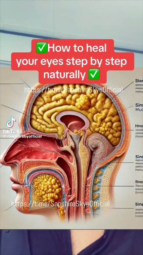 Elon Musk ( Parody ) (@argosaki) on X Eyesight Improvement, Anti Aging Yoga, Eyes Step By Step, Eye Muscles, Vision Health, Eye Exercises, Eye Sight Improvement, Nasal Passages, Stay Consistent