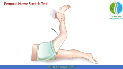 Femoral Nerve Stretch Test Sartorius Muscle, Quadriceps Femoris, Femoral Nerve, Nerve Anatomy, Root Stretch, Lumbar Disc, The Nerve, Orthopedic Surgery, Sports Medicine