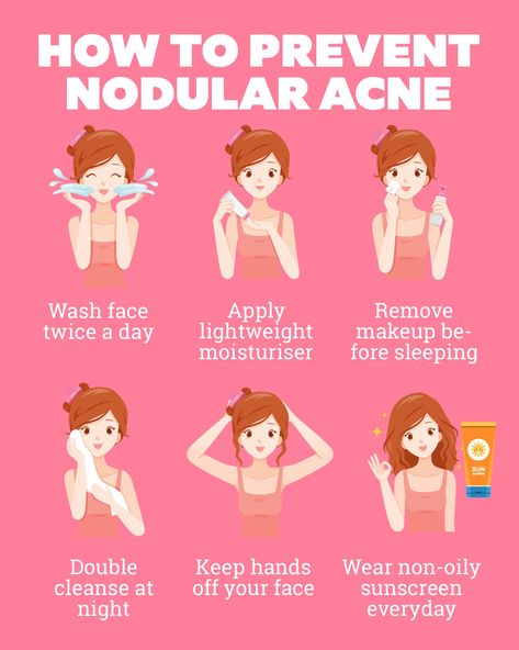 How to prevent nodular acne? Makeup By Face Shape, Nodular Acne, Heart Shaped Face Hairstyles, Laser Clinic, Laser Clinics, Hair Concerns, Hair Chalk, Facial Peel, Moisturizing Toner