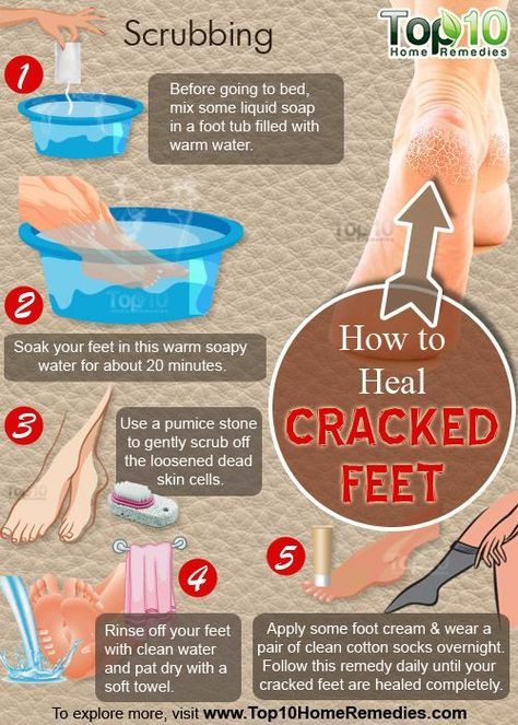 Cracked Heel Remedies, Diy Pedicure, Cracked Heels, Healthy Routine, Diy Skin Care, Manicure Y Pedicure, Diy Skin, Beauty Skin Care Routine, Health And Beauty Tips