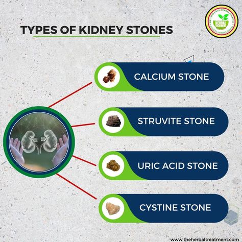 Unani Medicine, Investigatory Project, Kidney Stone, Vaseline Lip Therapy, Plant Benefits, Vaseline Lip, Uric Acid, Good Health Tips, Improve Sleep