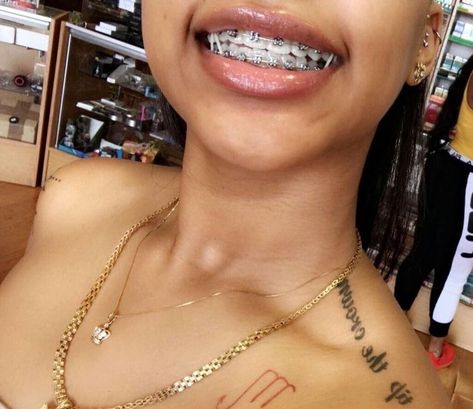 Follow: T I N Y Y for more Invisible Teeth Braces, Silver Braces, Braces Smile, Black Braces, Cute Braces Colors, Pretty Teeth, Braces Tips, Getting Braces