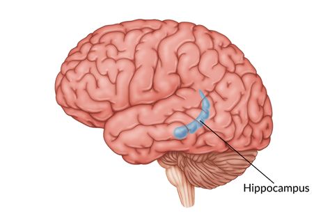 Frontal Lobe Damage, Hippocampus Brain, Temporal Lobe, Types Of Strokes, Occipital Lobe, Brain Surgeon, Cerebral Cortex, Frontal Lobe, Cognitive Therapy