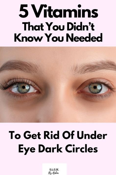 under eye dark circles What To Do With Dark Circles, Treat Dark Circles Under Eyes, Dark Around Eyes, Eye Bag Remedies, Under Eye Dark Circles, Eye Dark Circles, Eyes Care, Dark Circle Remedies, Under Eye Fillers