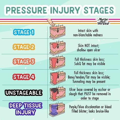 Pressure Injury, Nursing School Studying Cheat Sheets, Wound Care Nursing, Nursing School Life, Nursing School Inspiration, Nursing School Essential, Nursing School Motivation, Medical School Life, Nurse Study Notes