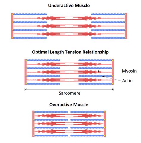 Straight Leg Raise, Nasm Cpt, Body Action, Pelvic Tilt, Muscle Imbalance, Desk Job, Bad Posture, Major Muscles, Muscle Body