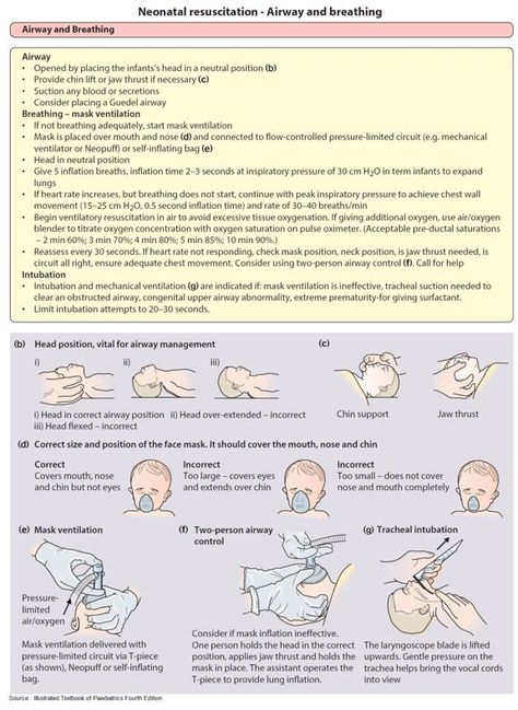 Neonatal Nursing, Pediatrics Nursing Notes, Pediatric Nursing Notes, Pediatric Nursing Respiratory, Nursing Notes Pediatric, Neonatal Resuscitation, Pediatric Nursing Mnemonics, Neonatal Resuscitation Cheat Sheet, Pediatric Vital Signs