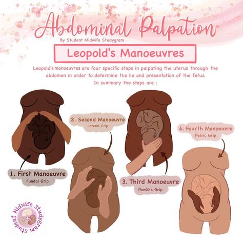 Student Midwife Studygram on Instagram: “🙏🏼 Abdominal Palpation ~ Leopold’s Manoeuvres ~ Christian Gerhard Leopold (1846-1911)] 🙏🏼 Leopold manoeuvres are a way to determine how…” Nurse Midwife Student, Student Midwife Studygram, Leopolds Maneuver, Nursing School Studying Cheat Sheets, Nurse Teaching, Midwifery Student, Student Midwife, Nursing School Essential, Medical School Life