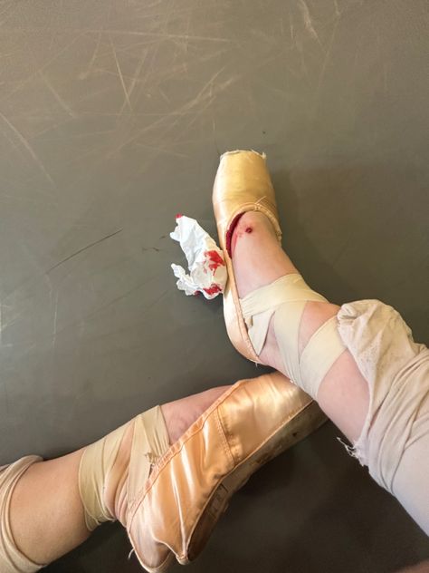 Dancer Aesthetic Ballet, Ballet Injury, Ballet Injuries, Messy Ballet Aesthetic, Bloch Ballet Aesthetic, Real Ballet Core, Ballet Feet Damage, Ballet Rehearsal, Ballet Dancer Aesthetic Dark