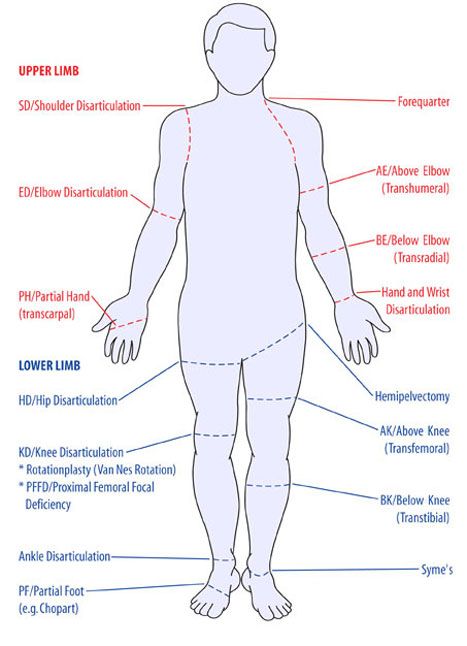 Amputation Levels Physiotherapy Knowledge, Nbcot Exam, Pt School, Gait Training, Physical Therapy Student, Carnival Girl, Exam Review, Lower Limb, Acute Care