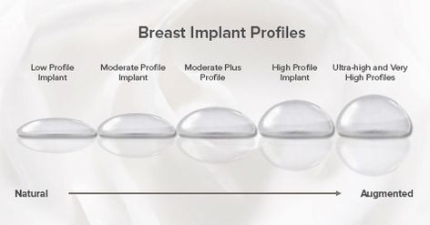 When it comes to breast augmentation there are many different options to choose from. Implants come in different sizes, shapes, and materials. However, the most commonly misunderstood characteristic of breast implants is their "profile." To better understand, read through our latest blog via this link. Mommy Makeover Surgery Recovery, Mommy Makeover Surgery, Increase Breast Size, Breast Implant Illness, Silicone Implants, Makeover Tips, Breast Reconstruction, Celebrity Plastic Surgery, Mommy Makeover