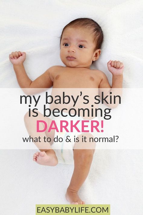 Some parents are truly worried about how their baby's skin color is developing. Learn what's normal regarding your baby's complexion. Baby care, skin color, baby tips, parenting, baby skin color change #baby Normal Quotes, 2 Month Old Baby, Baby Fair, Breastfeeding Baby, Baby Life Hacks, Dark Complexion, Skin Colour, Baby Care Tips, Skin To Skin