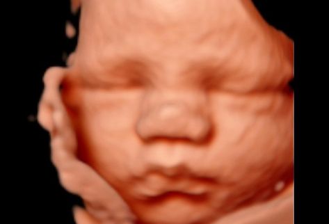 3D/4D Ultrasound Studio! 3d Ultrasound Pictures At 28 Weeks, Ultrasound Studio, 3 Weeks Pregnant Ultrasound, 9 Weeks Pregnant Ultrasound, 6weeks Pregnant Ultrasound, 3d Ultrasound, 4d Ultrasound, Medical Ultrasound, Baby Ultrasound